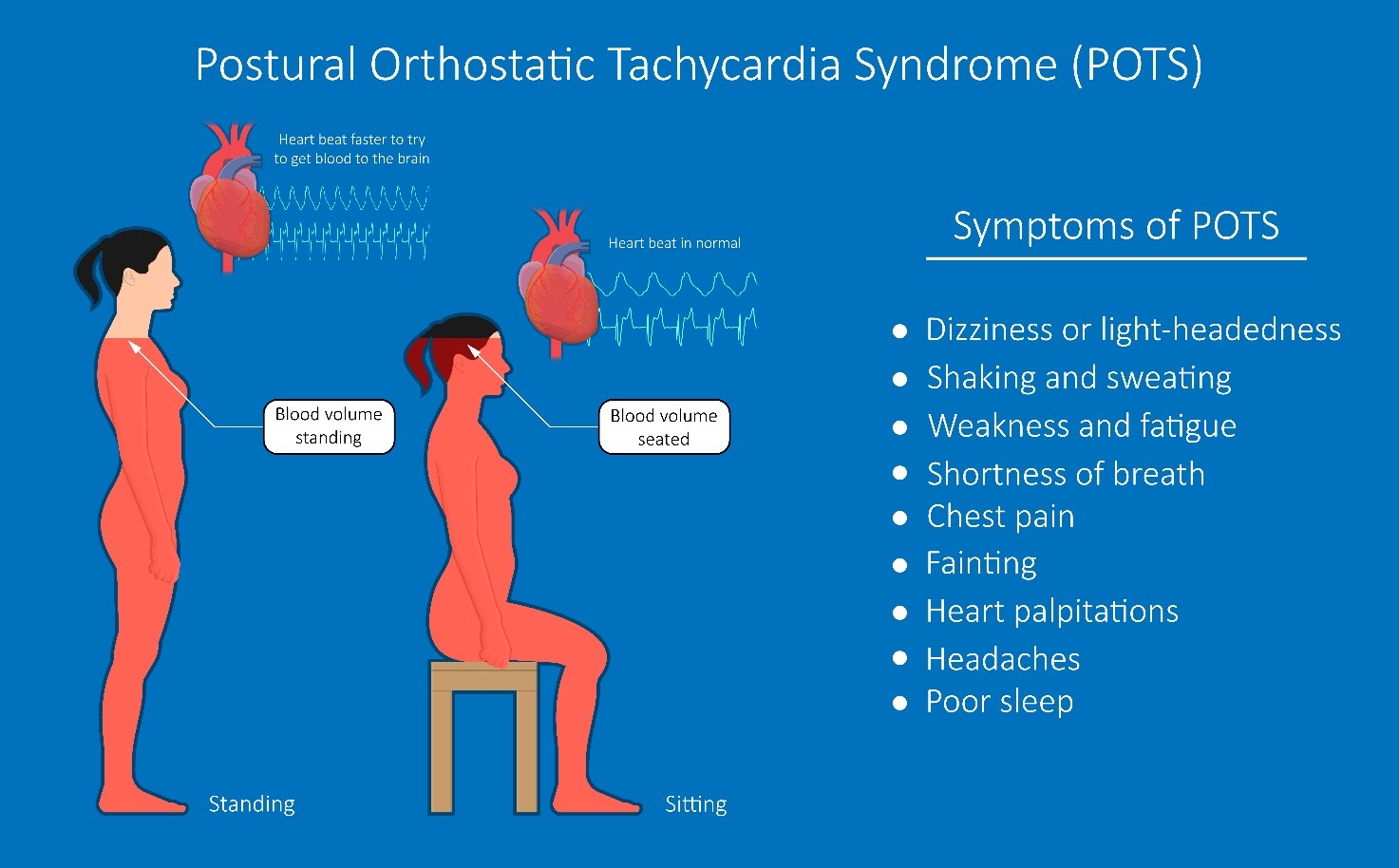 Treatment for Postural Orthostatic Tachycardia Syndrome Using Natural