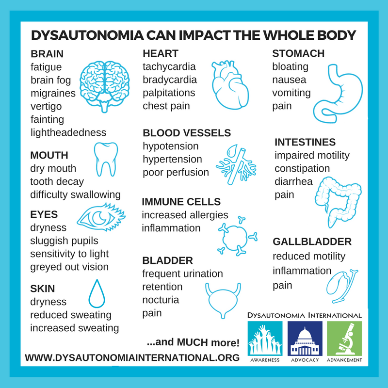 pots diagnosis Pots syndrome