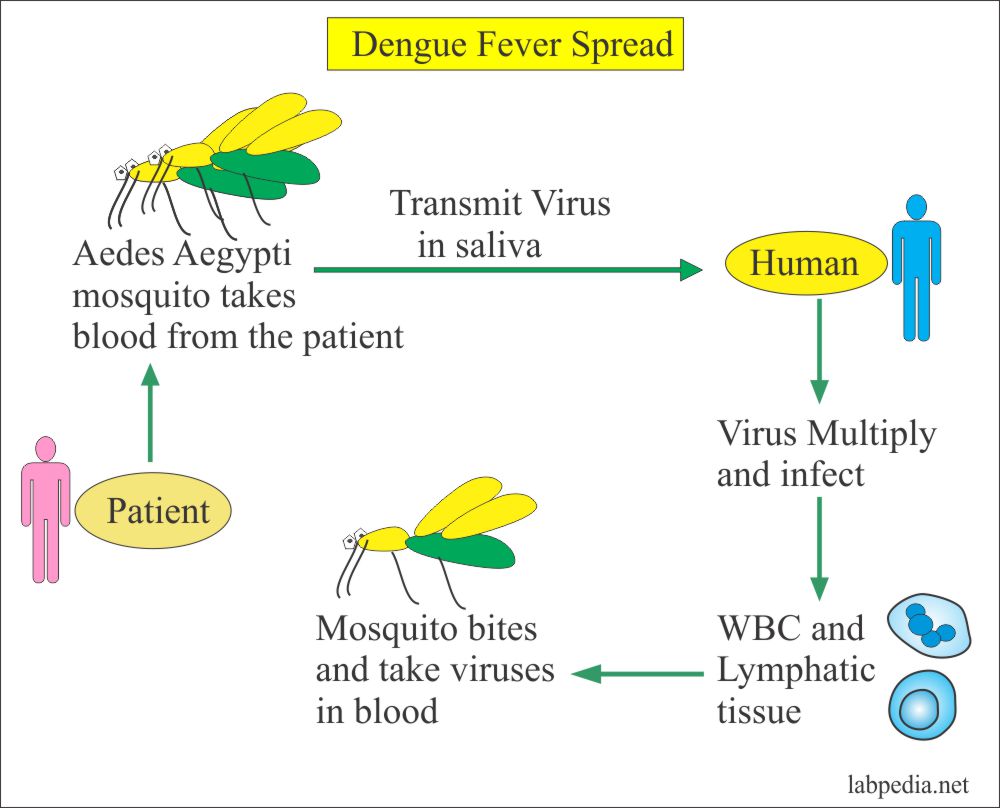 Dengue fever Dengue fever